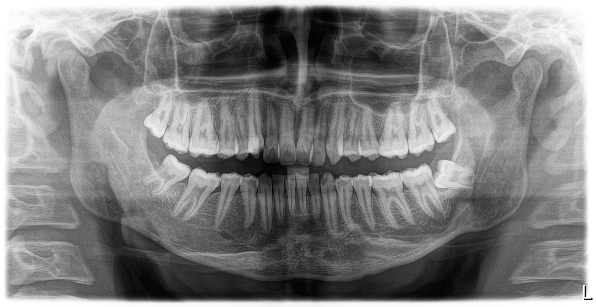 Radiografía panorámica dental